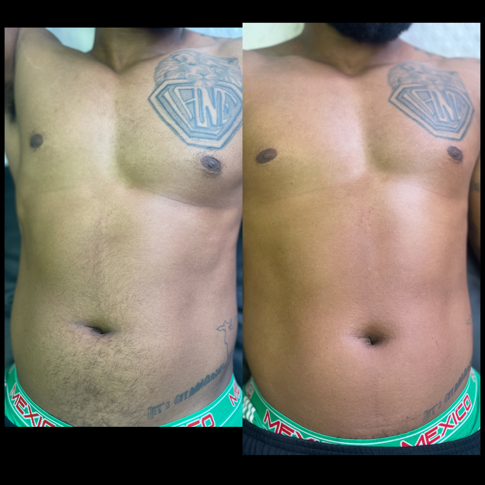 Chest & Abdomen Wax