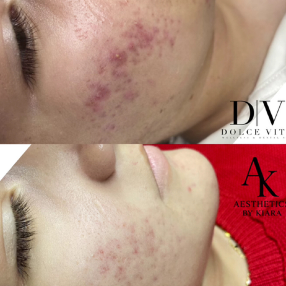Face Reality Clear Skin Program at Dolće Vita Wellness & Dental Spa in San Angelo, TX