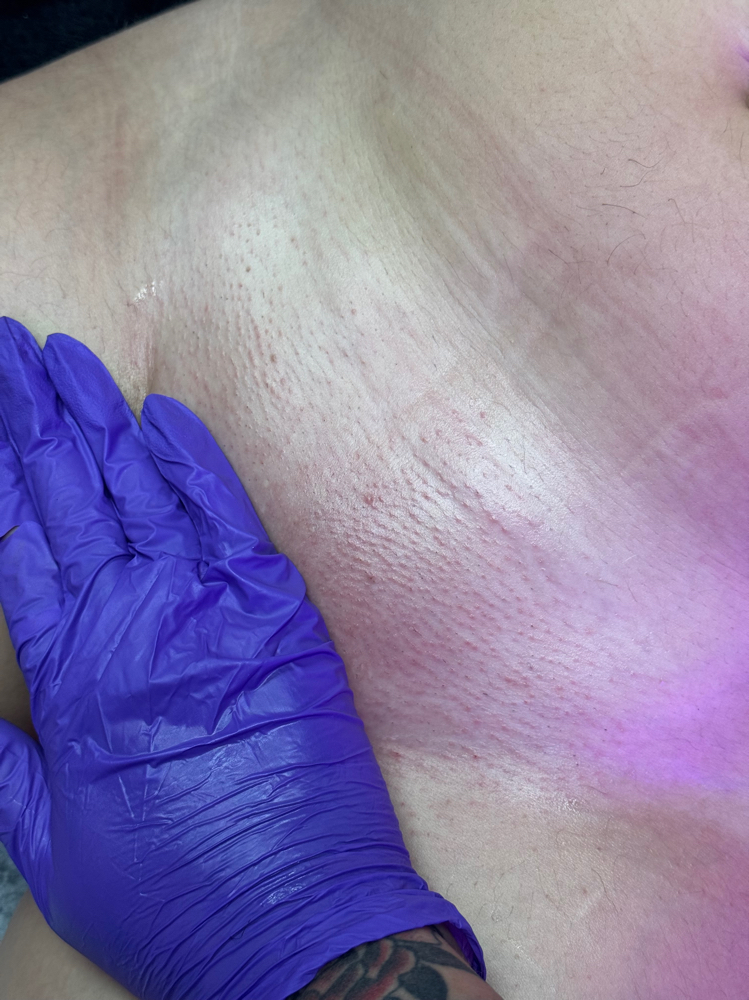 Brazilian Wax