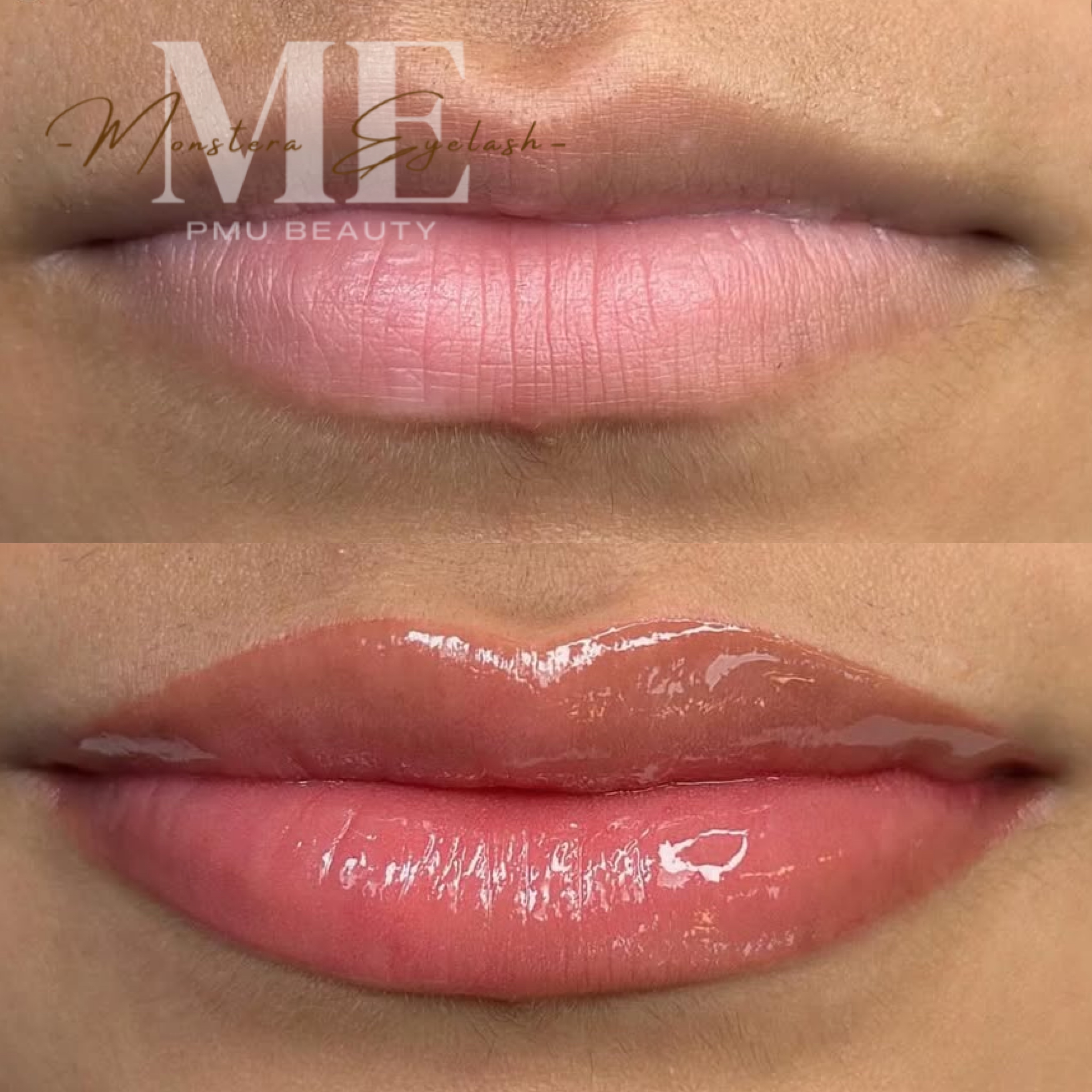 Dark Lip Neutralization