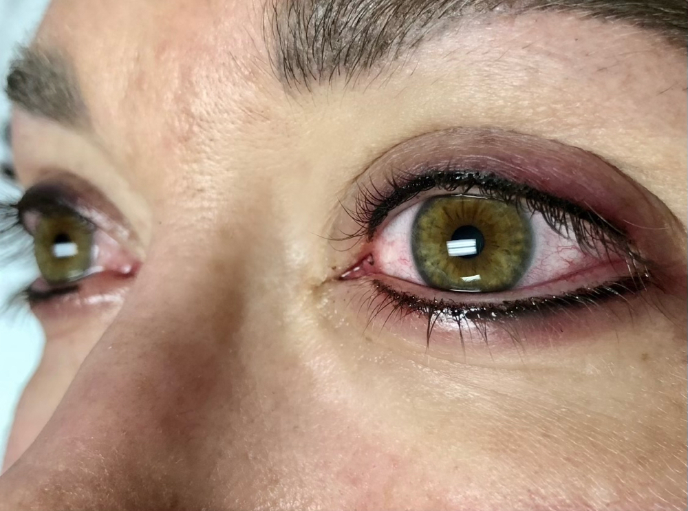 Eyeliner- Lash Enhancement Top Lid