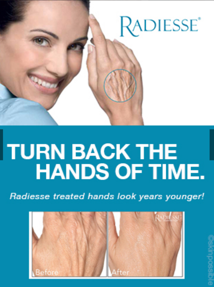 Hand Rejuvenation at Glow By Miranda in Phoenix, AZ