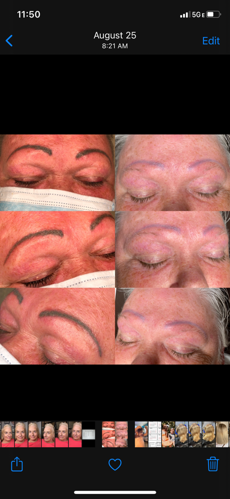 LiFT Tattoo Removal (Per Session)