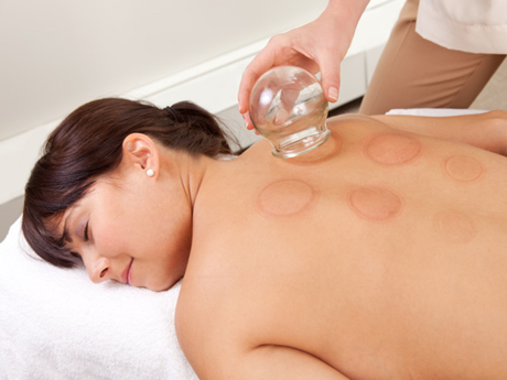 30 Minute Massage With Cupping