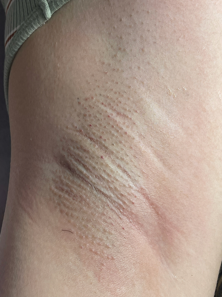Waxing/Under Arm