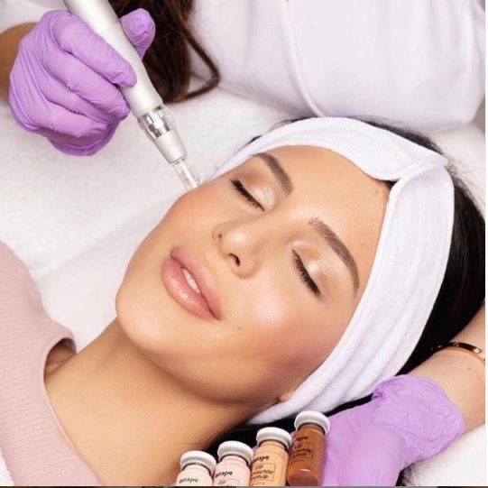 Microneedling