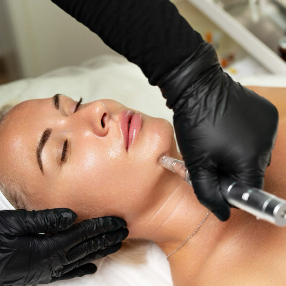 Nano-needling Pen at Lian Beauty Studio in Glendale, CO
