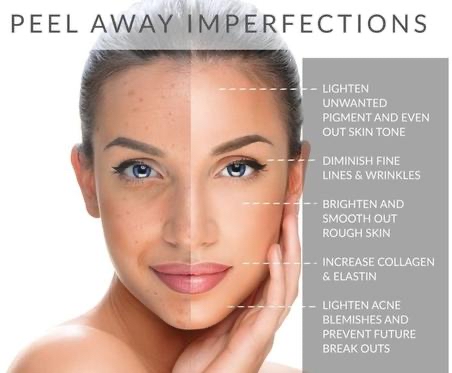 PCA Peel