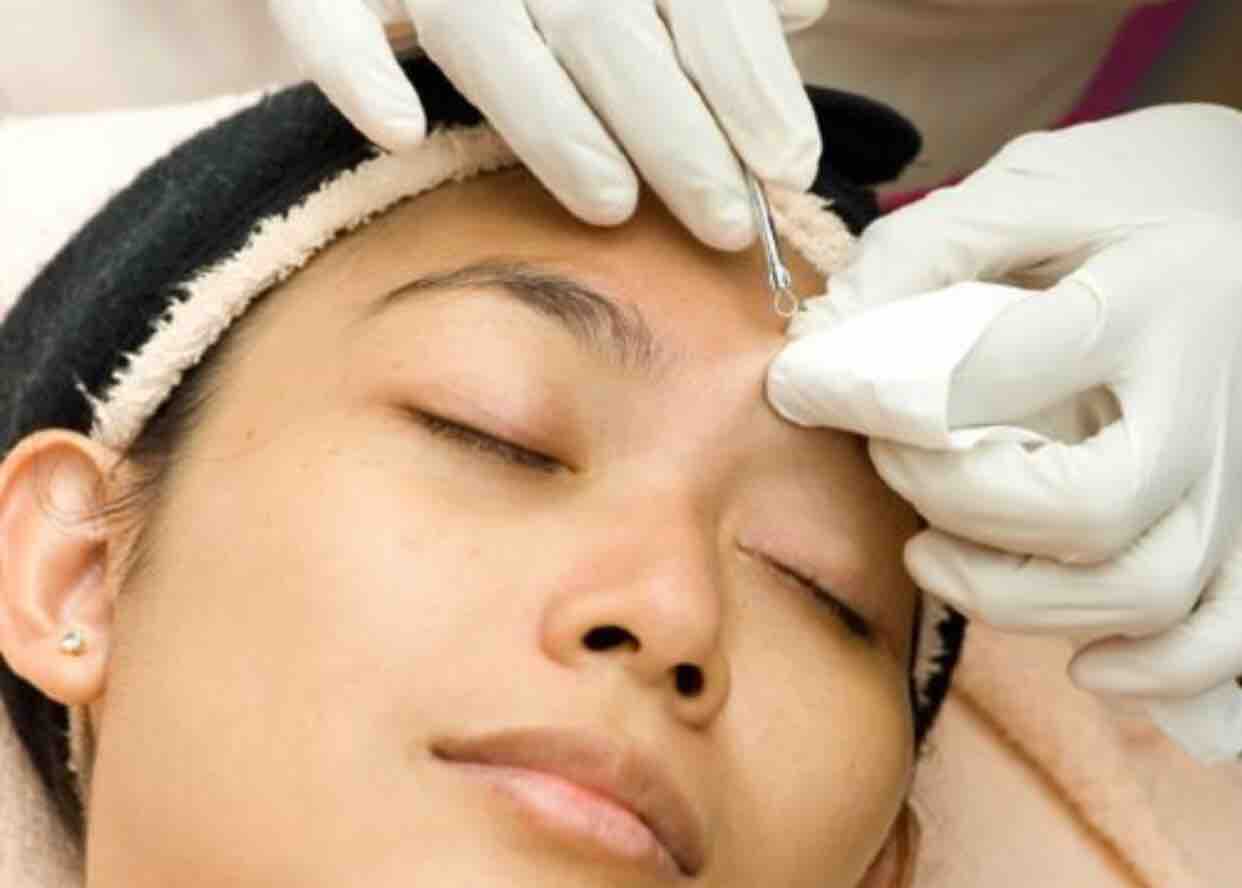 Extractions Add on to your facial.