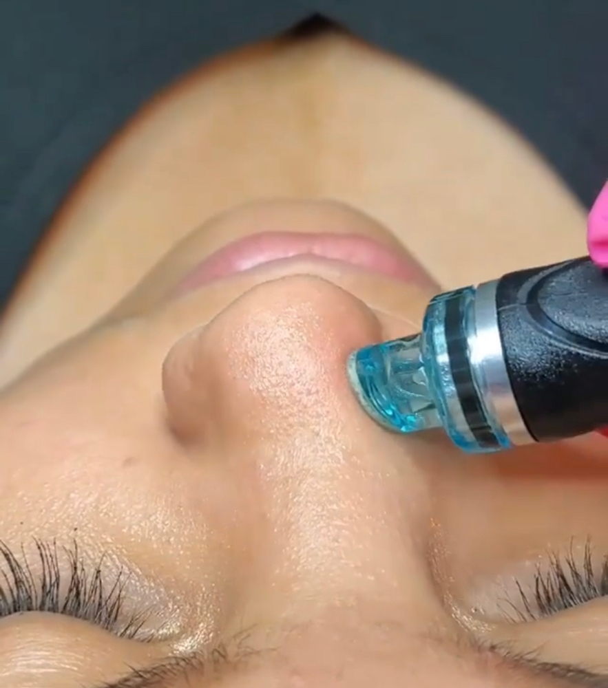 Hydro Facial