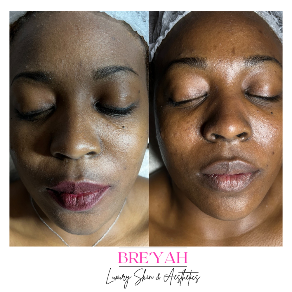 Glow & Renew Lux Facial
