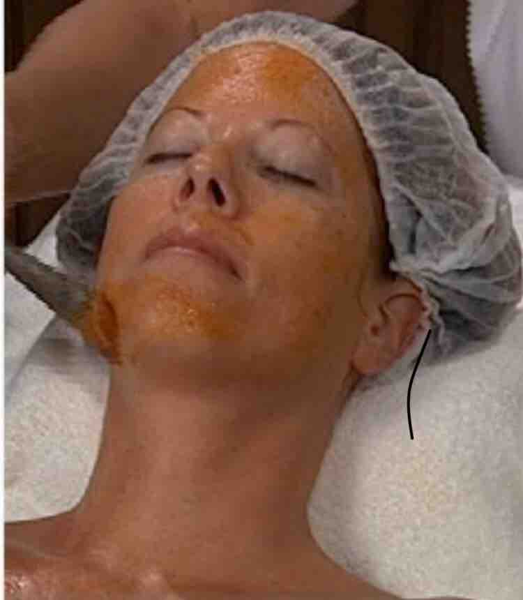 Pumpkin Facial
