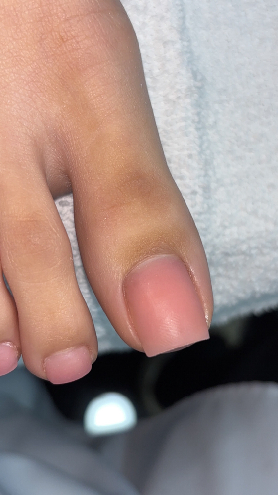 Acrylic on toes