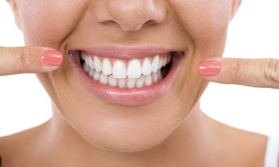 In-Office Teeth Whitening Session