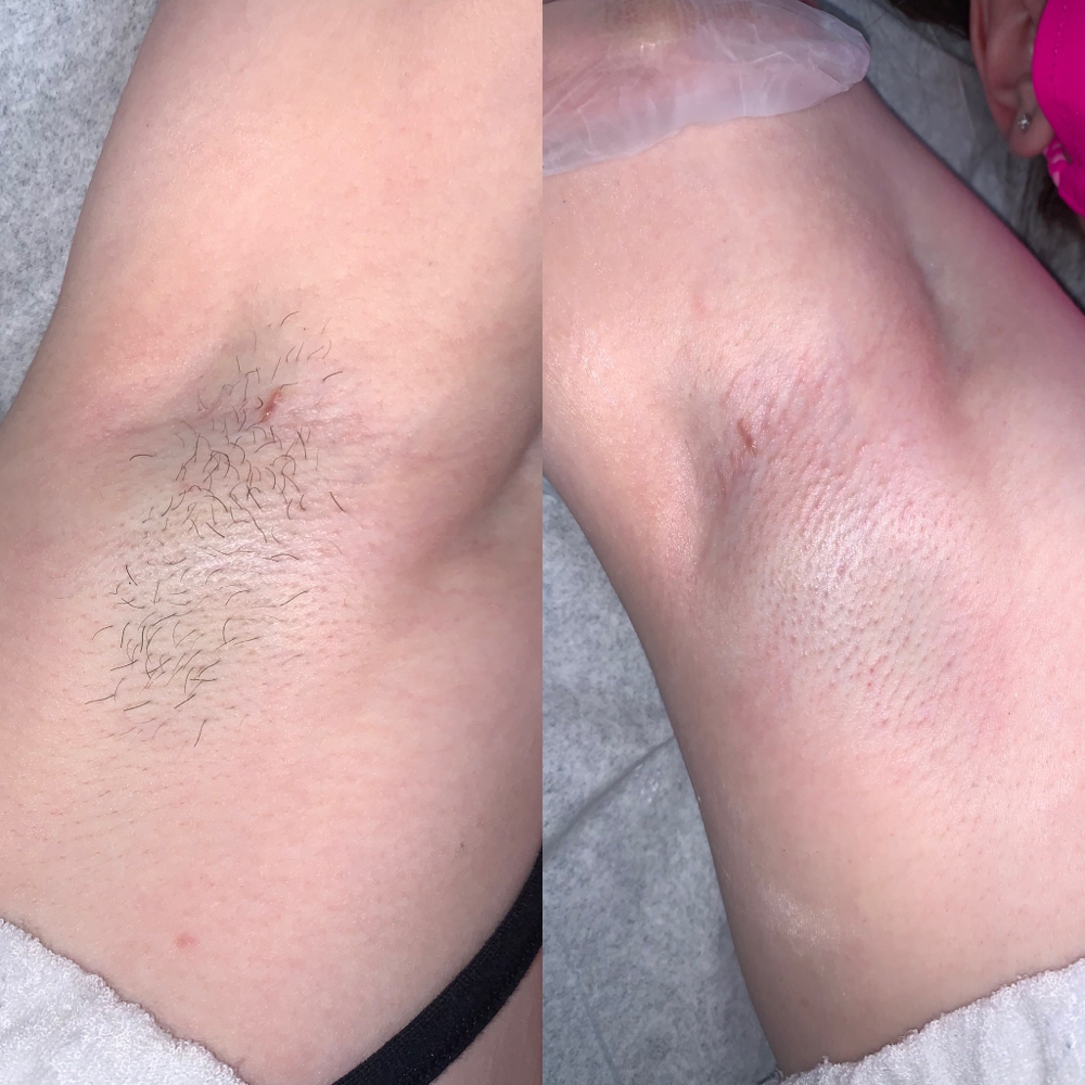 Underarm Wax