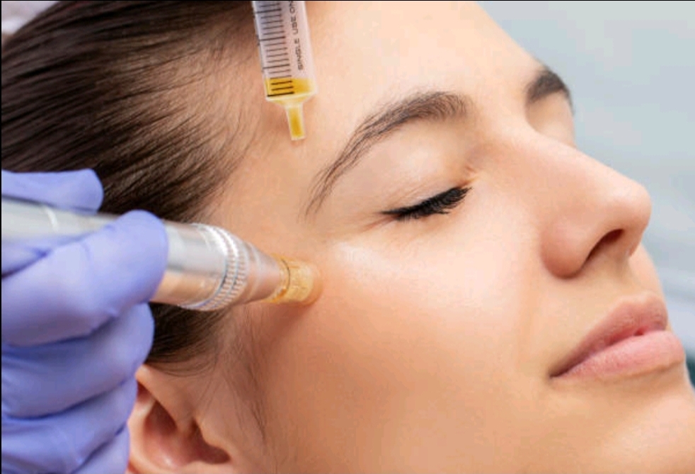 Nano MicroNeedling Lips And Eyes