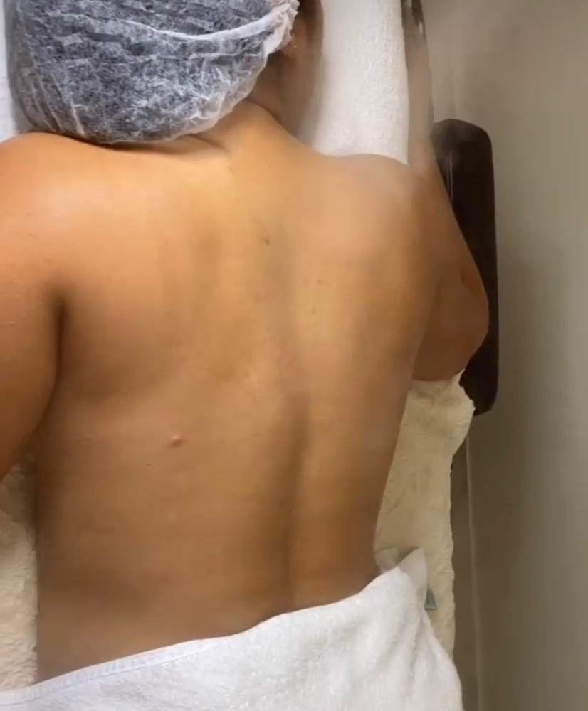 Back Facial