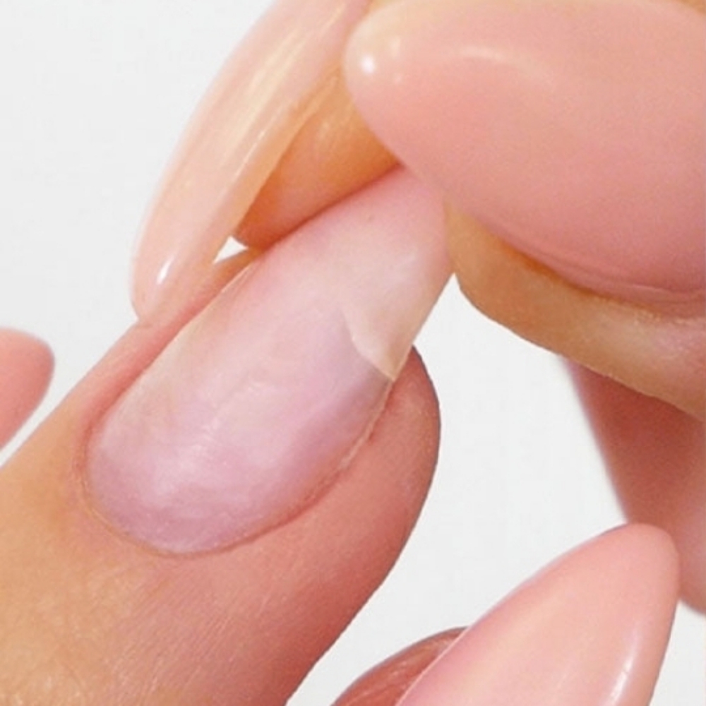 Nail Repair at Nail Elegance LLC in Redmond, OR