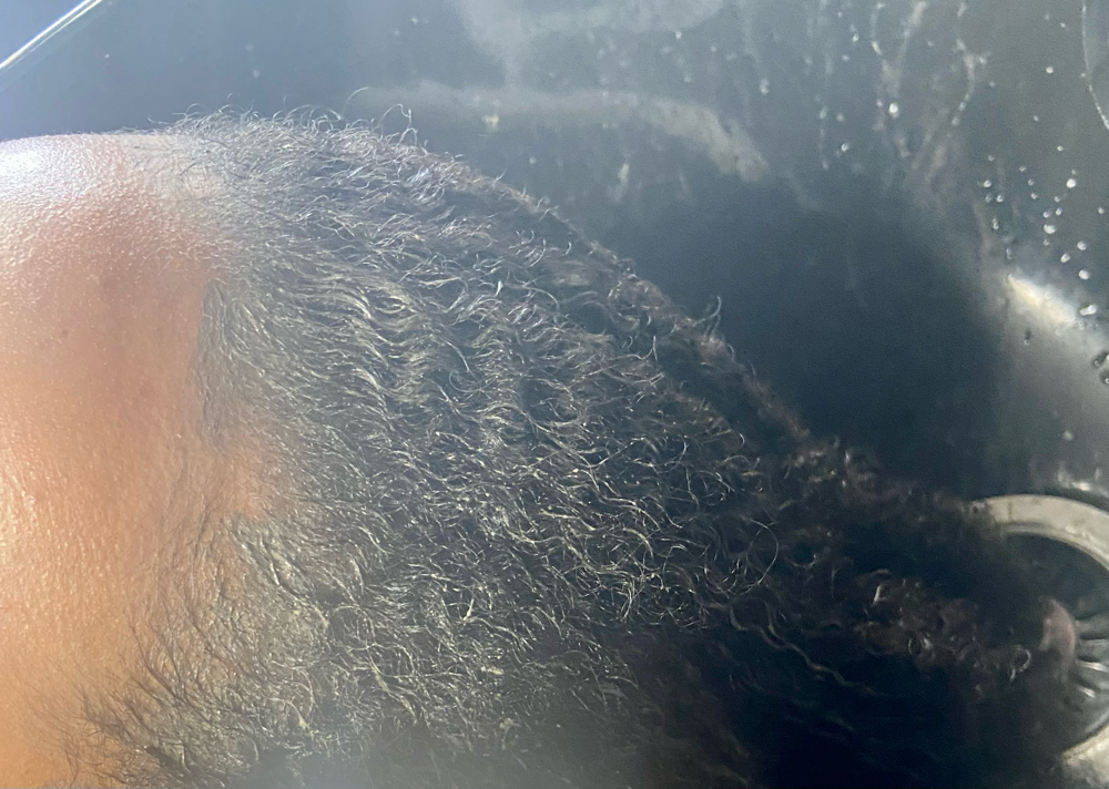 Scalp Exfoliation