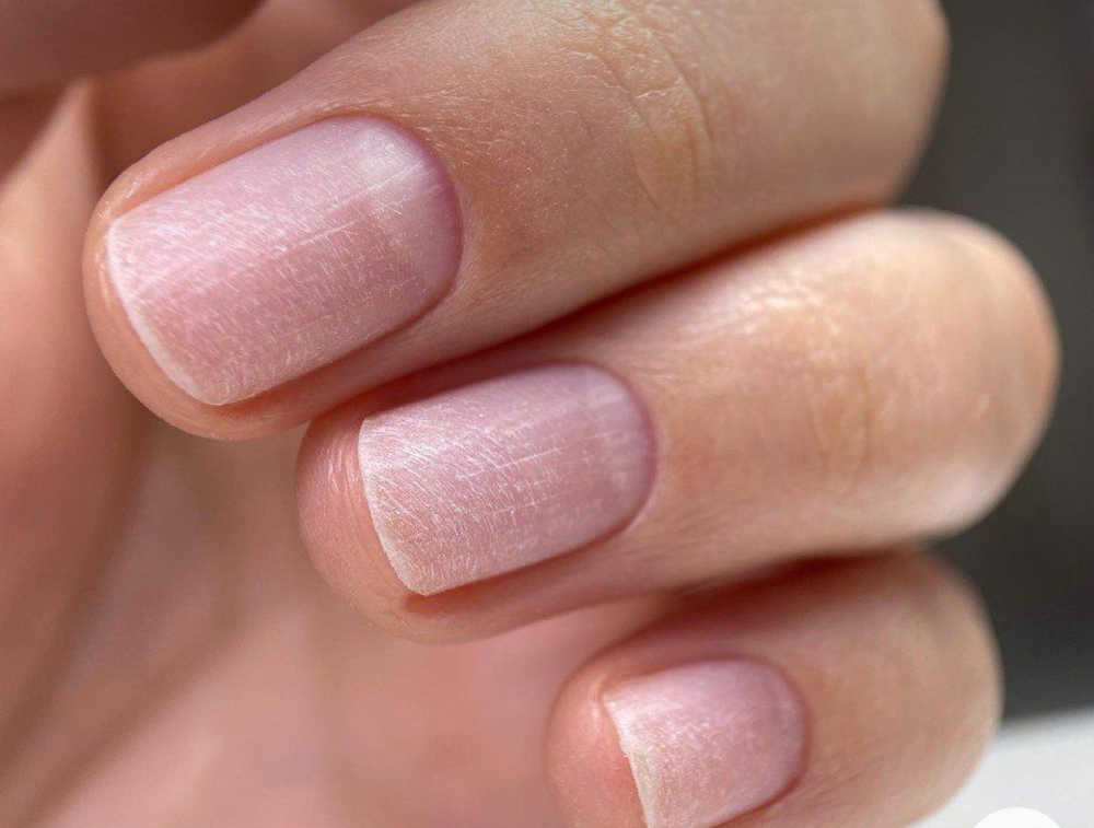 DIP/GEL TRANSITION TO REGULAR MANI