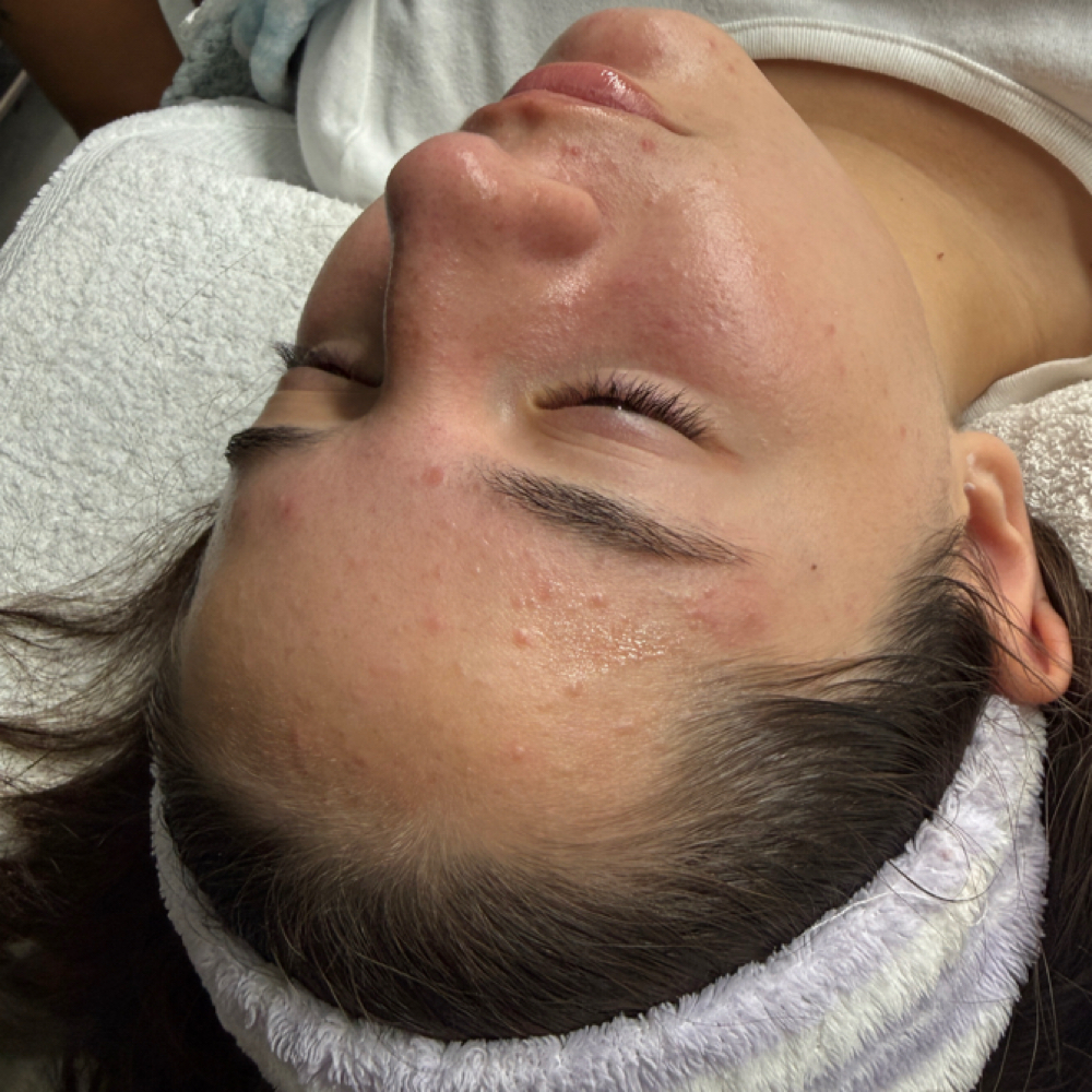 Teen / Tween Facial at Lala Beauty in Merced, CA