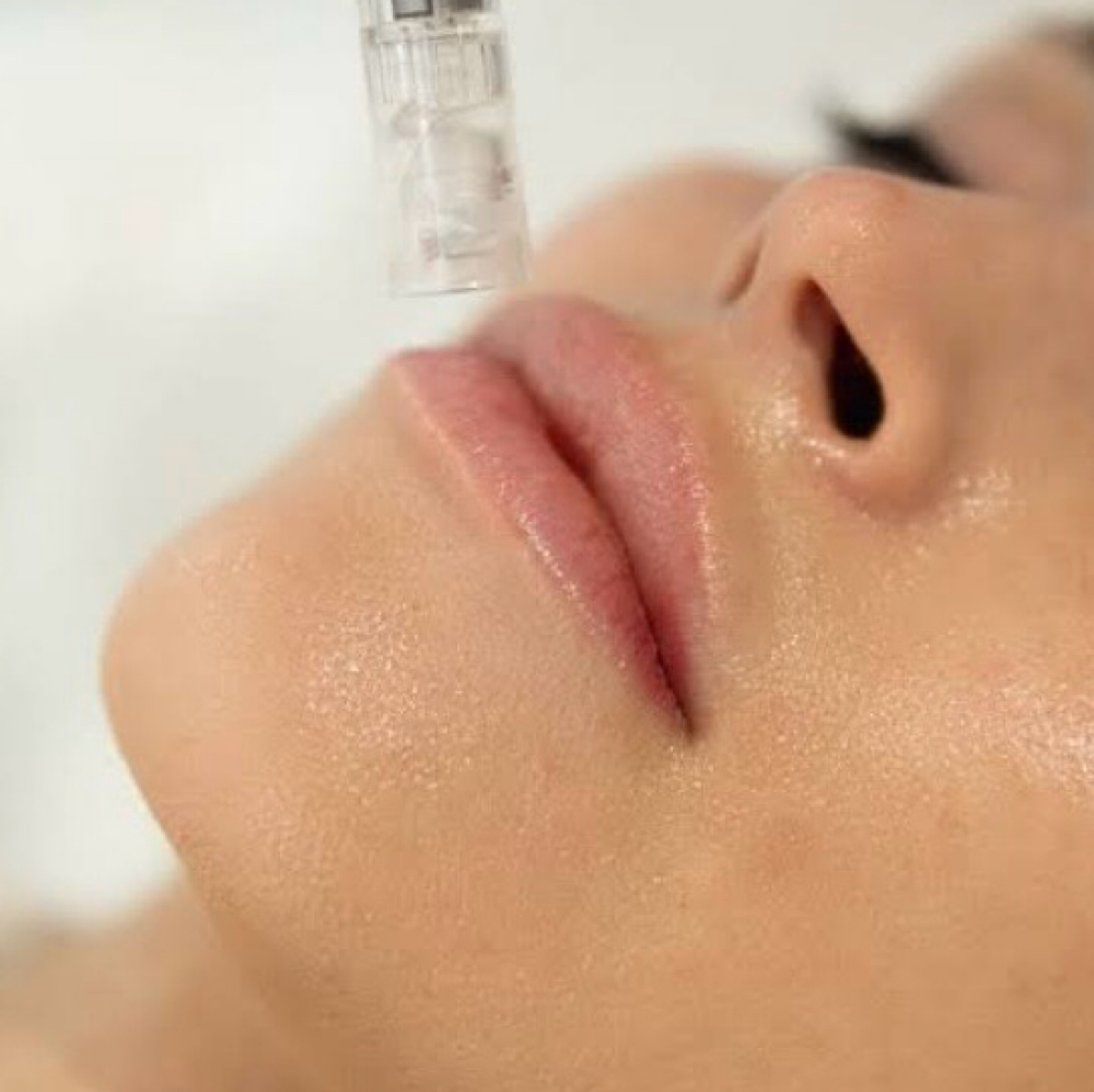 The Glass Glow Nano Infusion Facial at Esthetics by Leigh in Wareham, MA