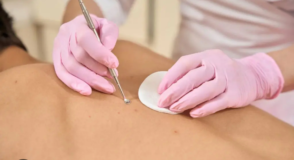 Back Facial at Esthetics by Dolly in Sacramento, CA