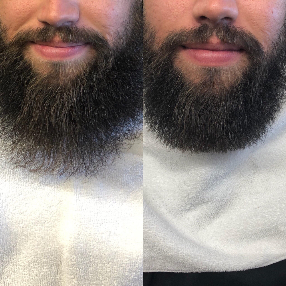 Beard Trim
