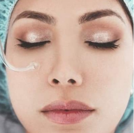 High Frequency facial