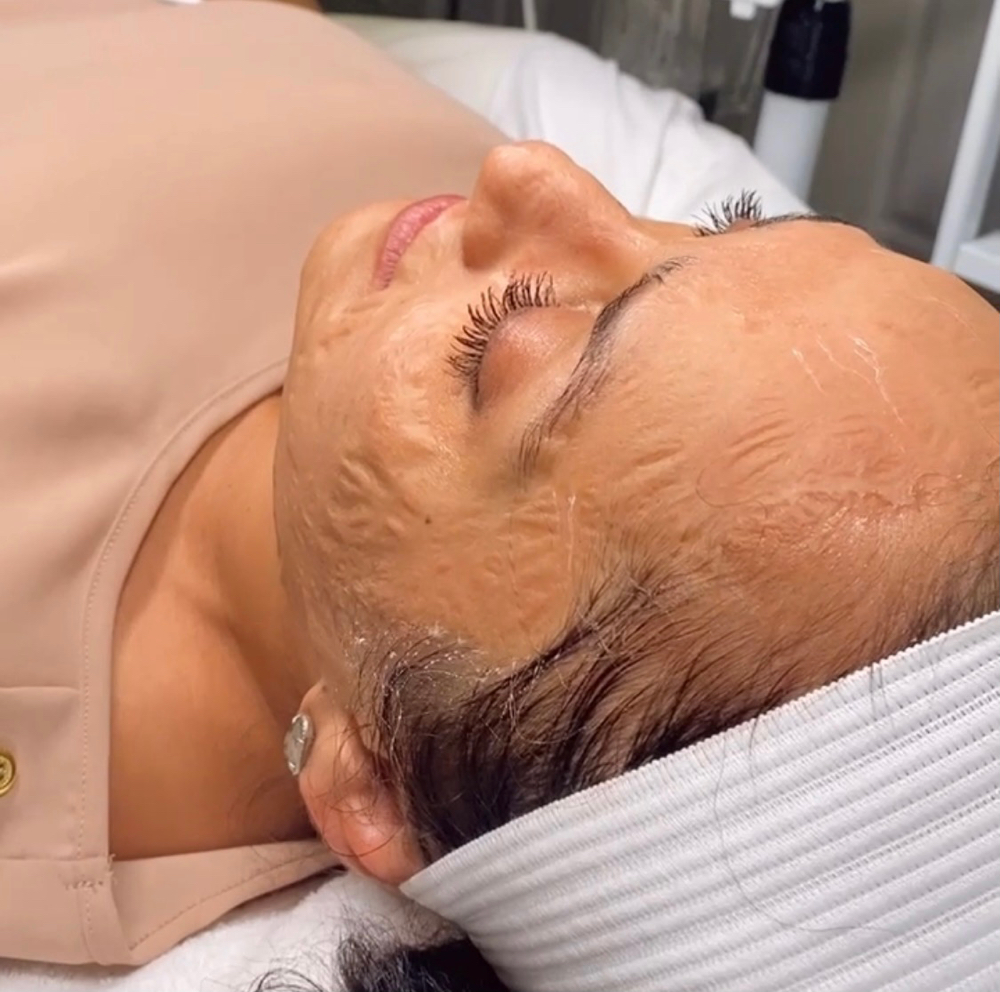 No-Tox mask