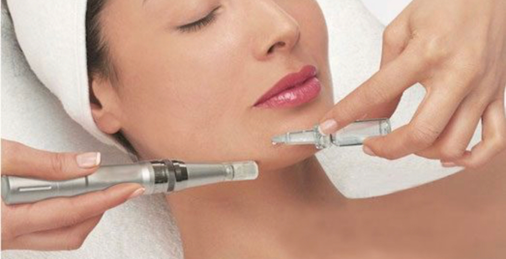 Microneedling