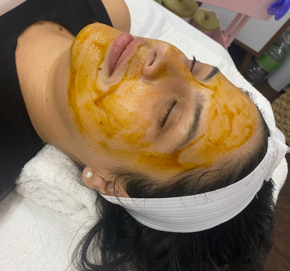 Peels
