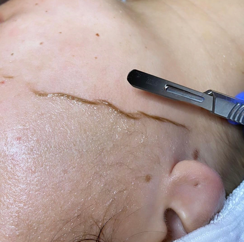 No Fuzz Given Dermaplaning Facial