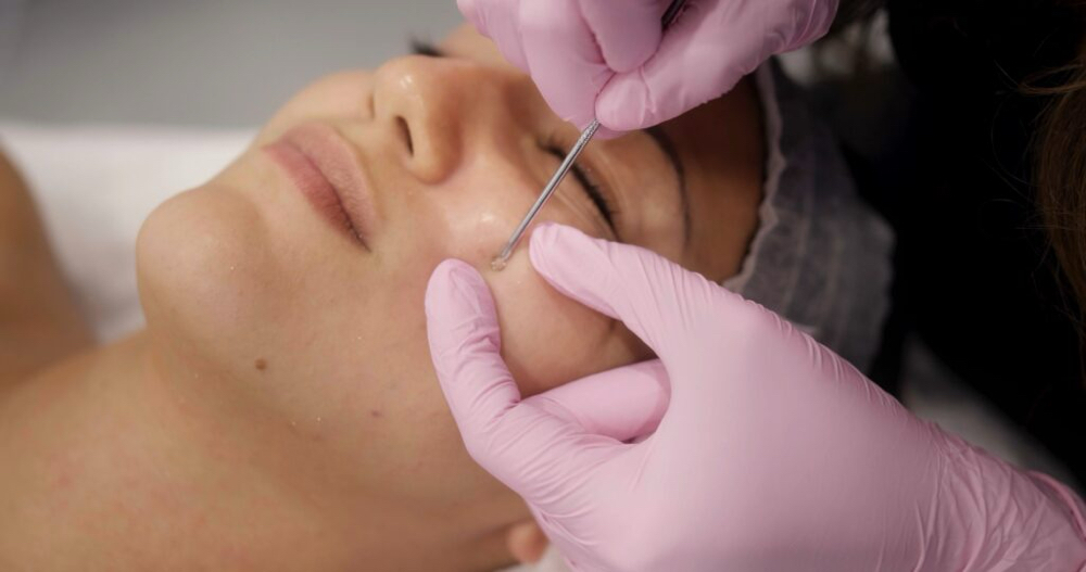 Extractions