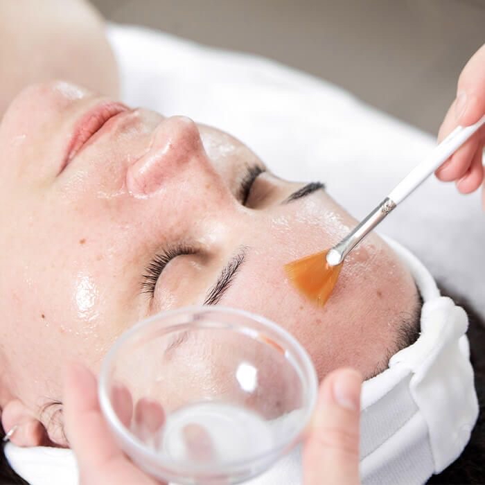Glycolic peel