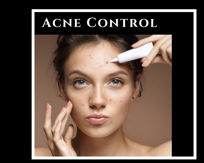 Acne Control Facial - Approx 75 min