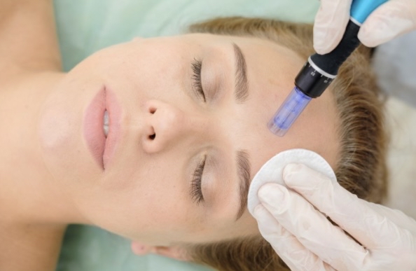 Microneedling & Red Light Therapy