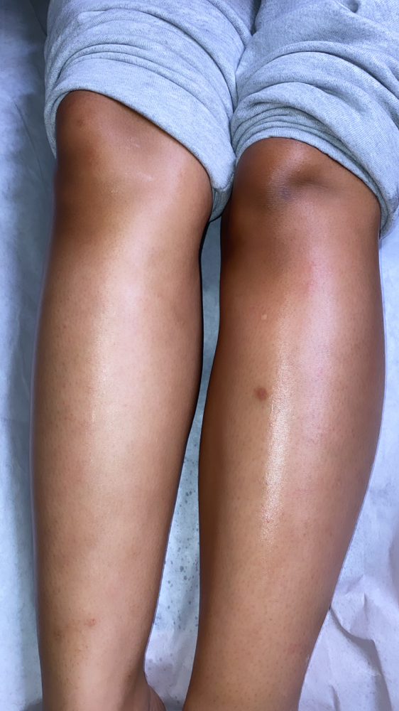Leg Wax(half)