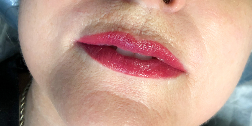 Lip Touch Up: 6-8 Weeks