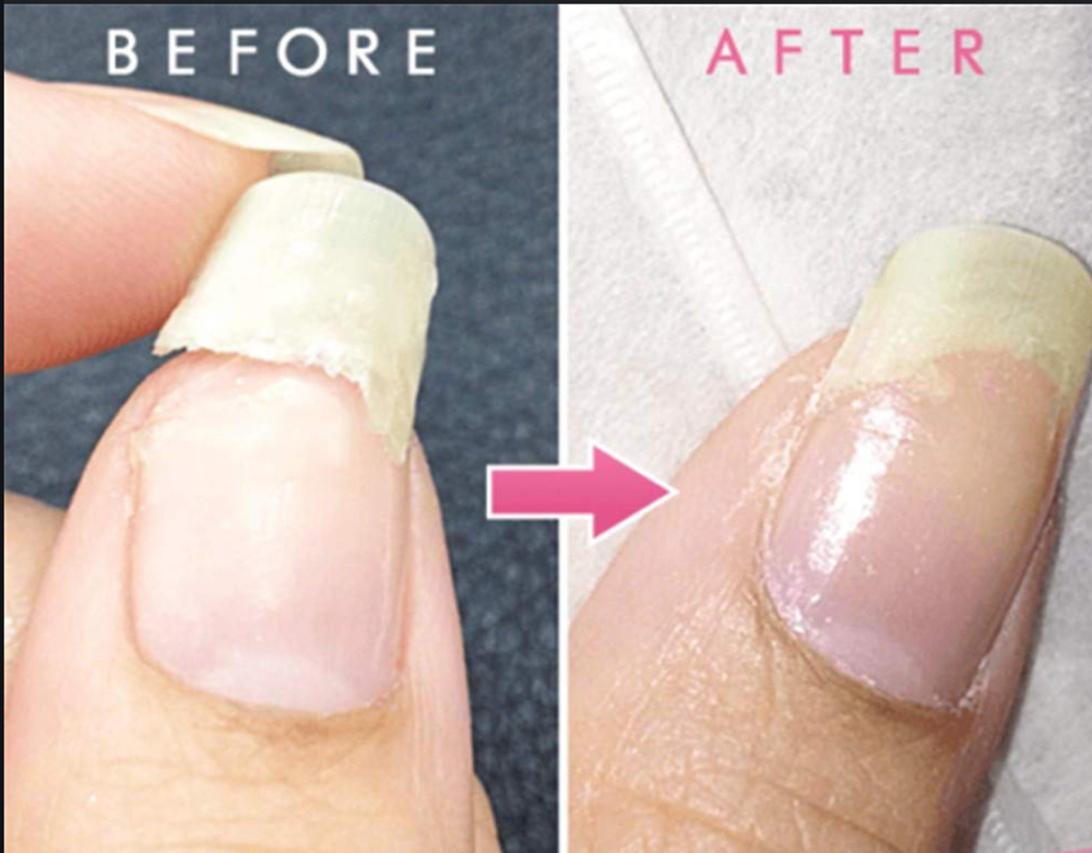Nail Fix