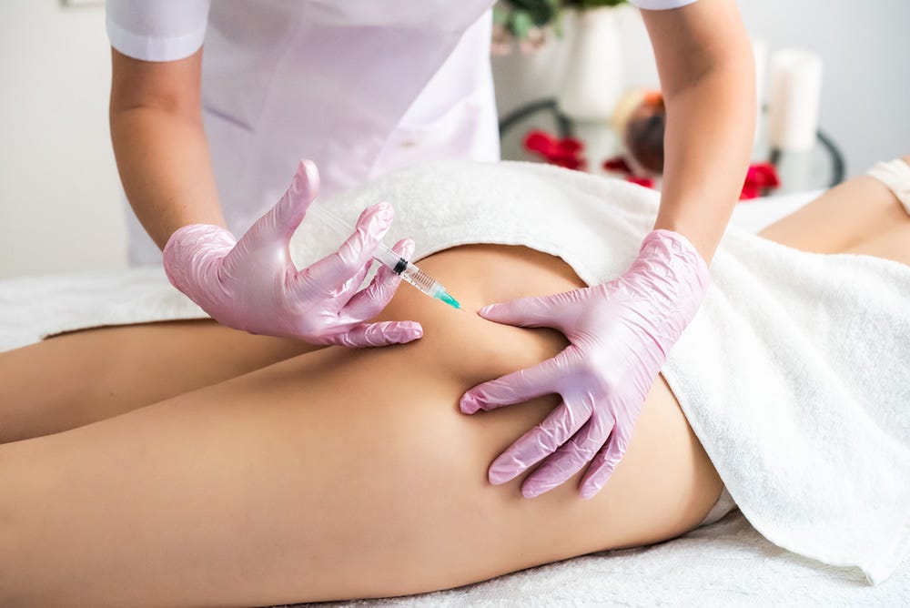 Butt Fillers