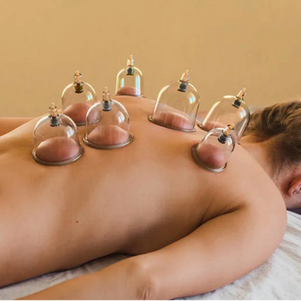 Cupping at Inner Serenity Massage & Wellness in Exeter, NH