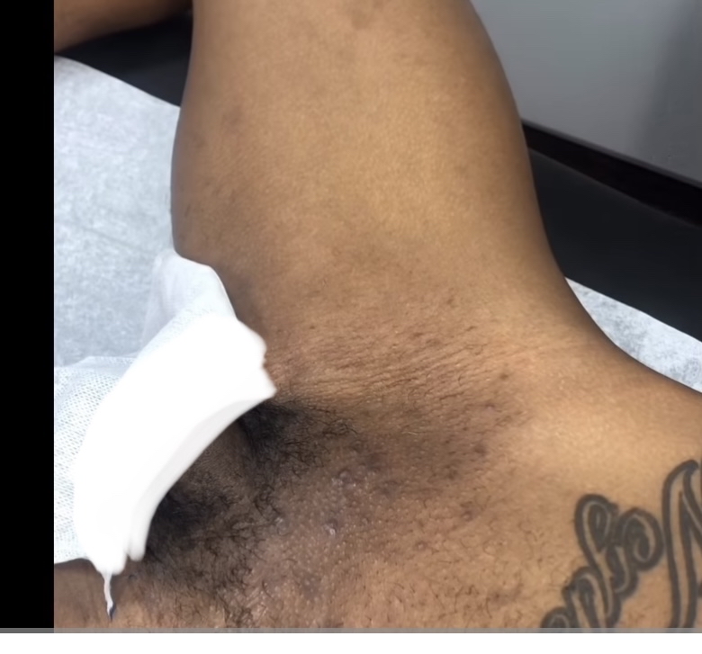 Brazillian For Men