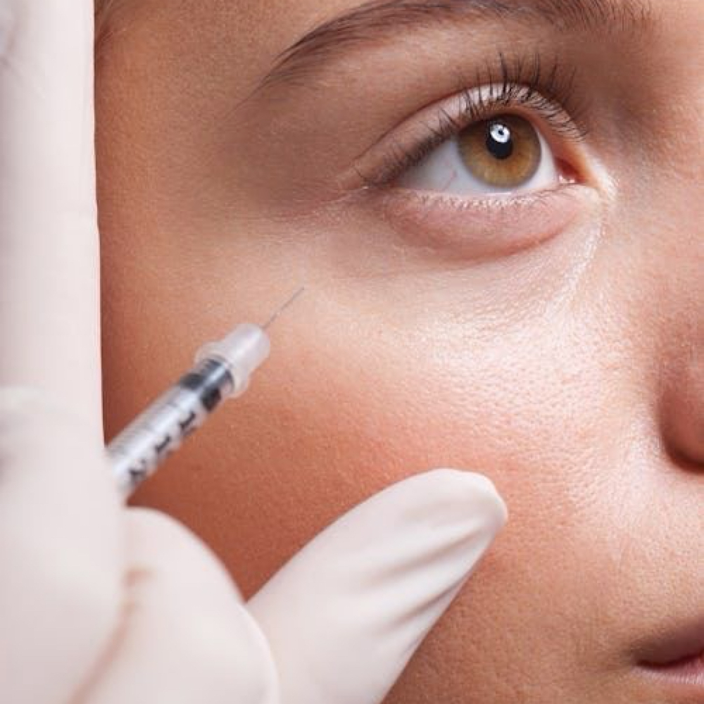 PRP Under-Eye Rejuvenation at Everlasting Aesthetics LLC in Surprise, AZ