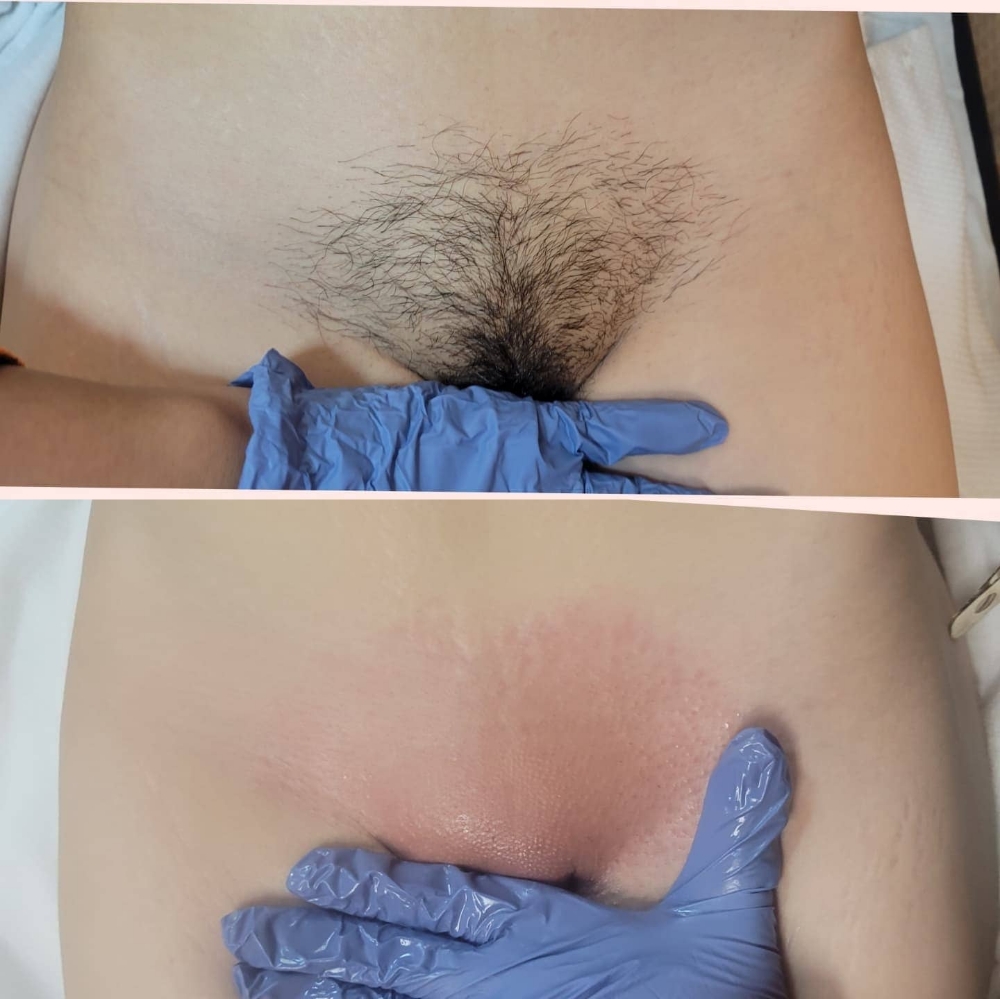 Brazilian Wax (first time)