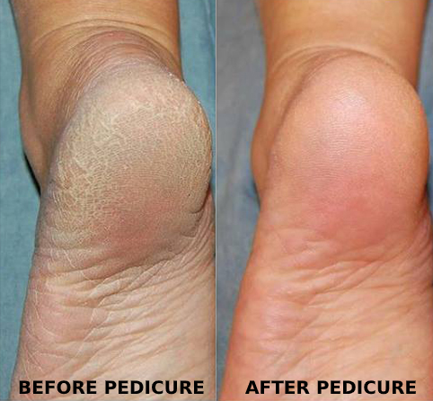 Gel Pedicure