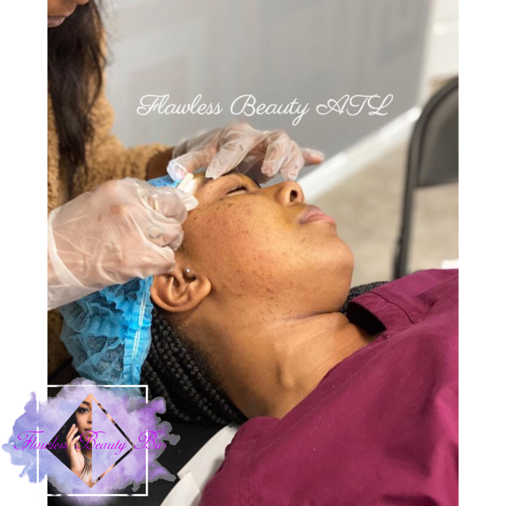 Derma-Planing