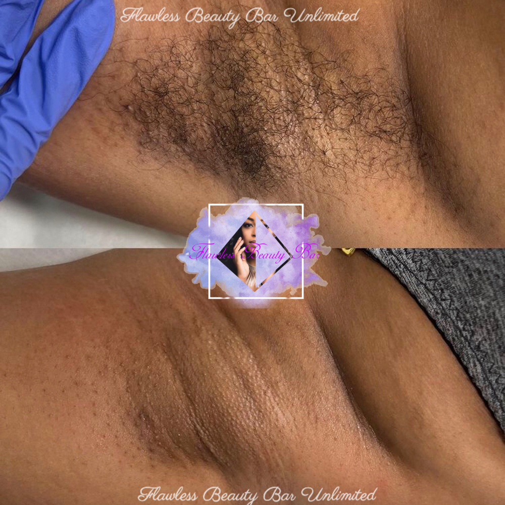 Underarm Waxing