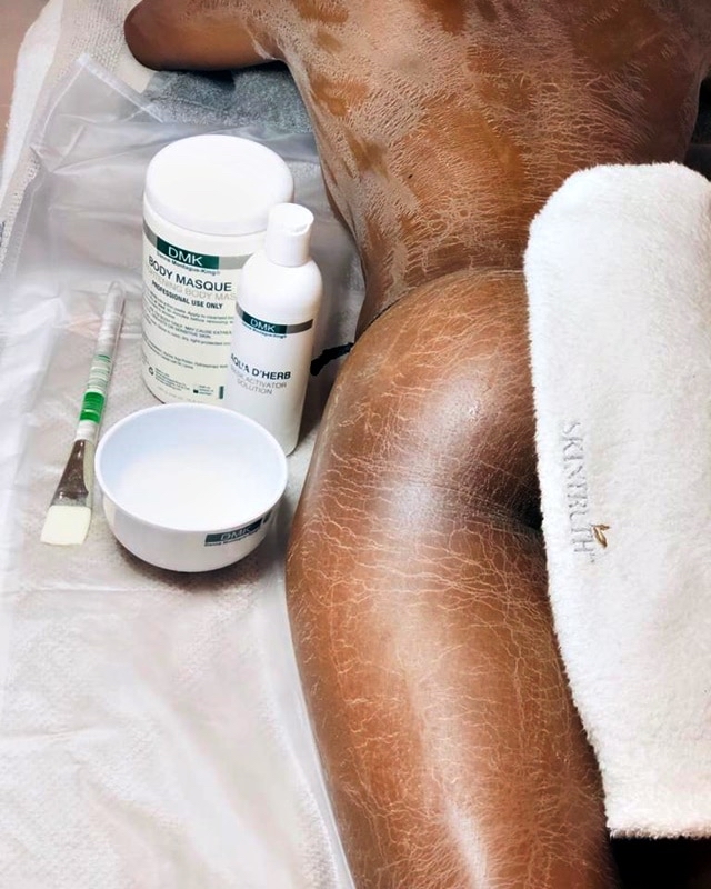 DMK Thigh Cellulite Treatment