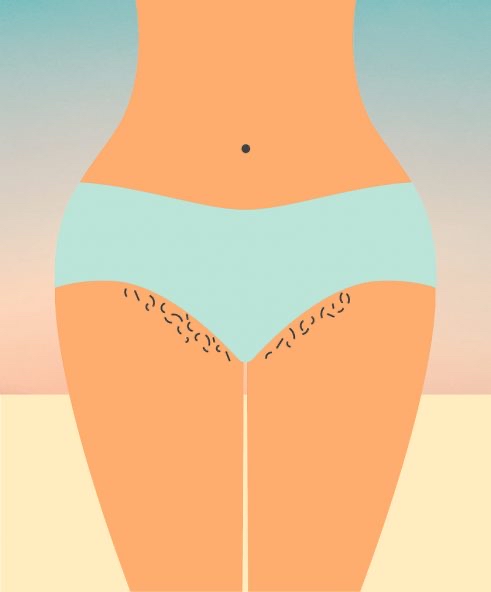 Bikini at Aestheticwink in Laredo, TX